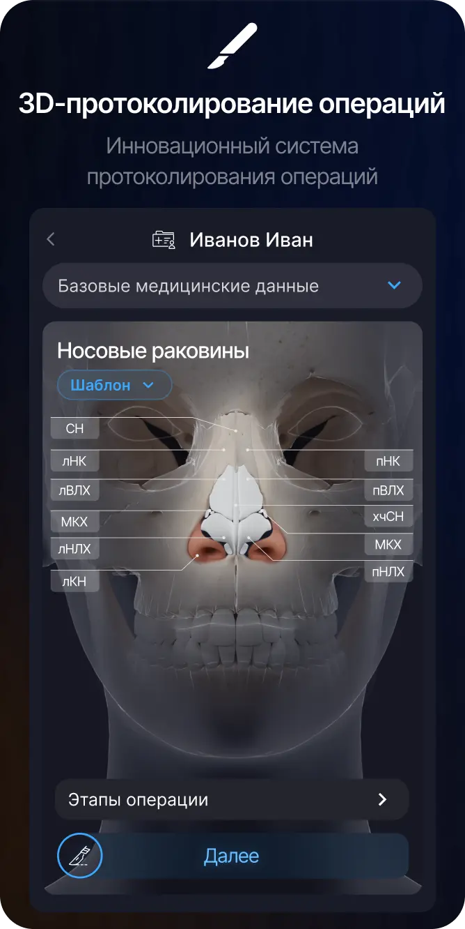 3D-протоколирование операций